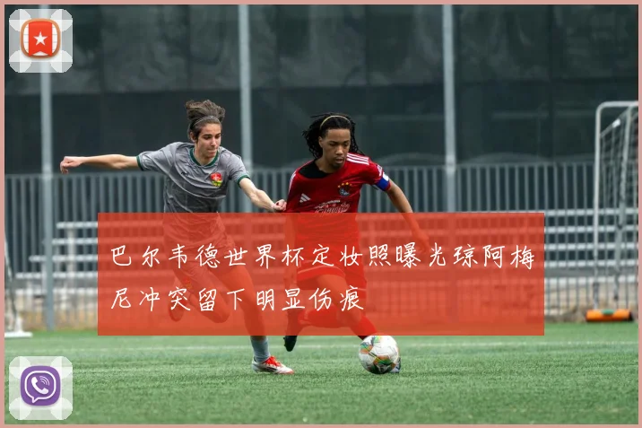 巴尔韦德世界杯定妆照曝光琼阿梅尼冲突留下明显伤痕